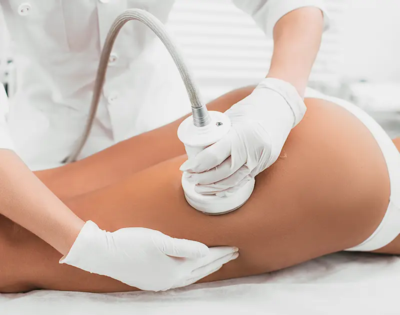 Cavitation